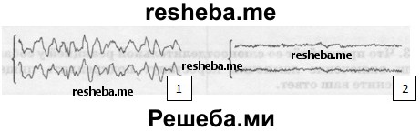 Электроэнцефалограммы спящего человека