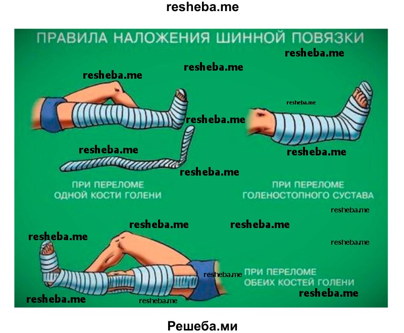 Пользуясь подручными материалами, попытайтесь правильно наложить шину на ногу или руку