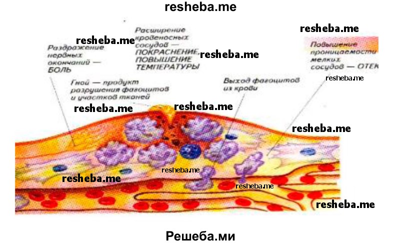 Составьте схему ответа иммунной системы на проникновение в организм возбудителя ангины 8 класс